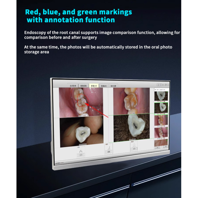 Dentalisches WLAN All-in-One-Intraorale Camera mit 24-Zoll-Touchscreen